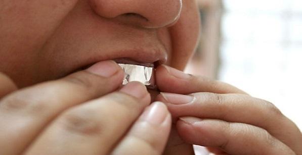 ماذا يحدث عند تغطية أسنانك بورق الألمنيوم لمدة ساعة 