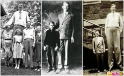 بالصور روبرت والدو أطول إنسان في التاريخ الحديث