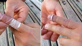 كيف تخلع خاتما عالقا من اصبعك؟