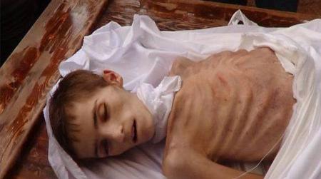 مضايا تموت جوعًا والأمم المتحدة في إجازة