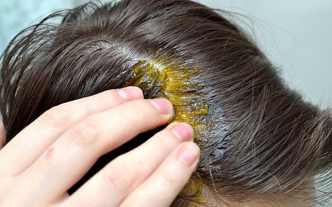 7 وصفات منزلية لعلاج تساقط الشعر