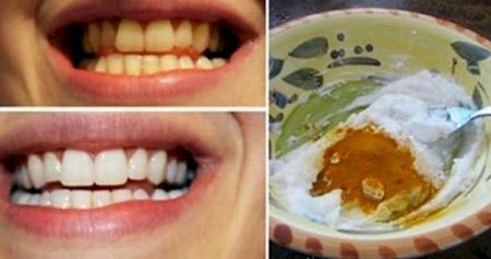 تبيض الاسنان بمكونات منزليةلا تستطيع تصديق النتائج المذهلة