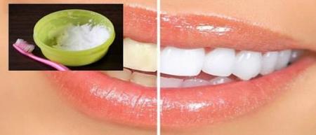 وصفة بسيطة جدا ستندهش من مفعولها السحري في تبييض أسنانك والتخلص من تراكمات الفطريات الداكنة عليها