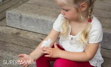 أعراض حساسية الجلد لدى الصغار وطرق علاجها