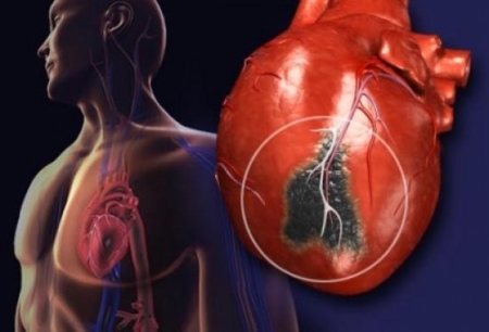 أربعة أشياء تحدث قبل حدوث النوبات القلبية 
