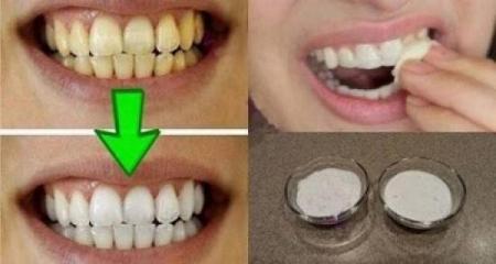 وصفة لتبييض الأسنان من الإستعمال الأول