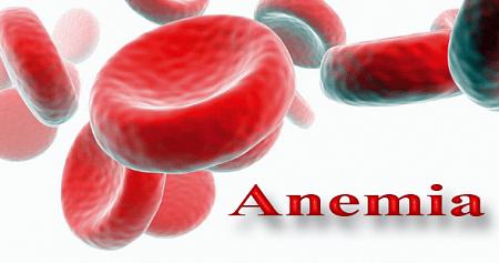 علاج الانيميا و فقر الدم بالوصفات