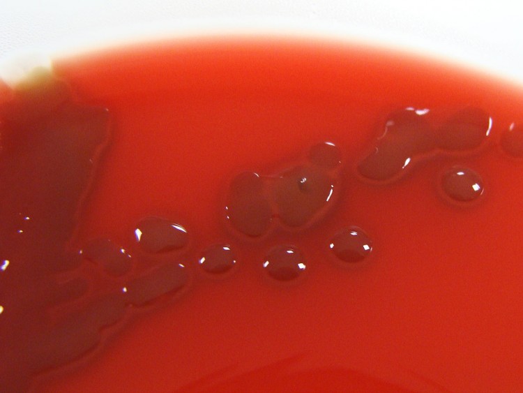 1280px-Streptococcus_pneumoniae_on_Columbia_Horse_Blood_Agar_-_Detail