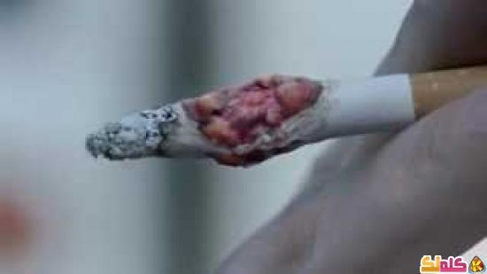 جديد إعلان بريطاني رائع يحذر من مخاطر التدخين