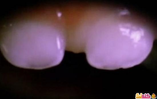 بالفيديو كيف تنمو أسنان الرضع 