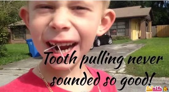 فيديو أب يخلع أسنان ابنه اللبنية بسيارة كامارو