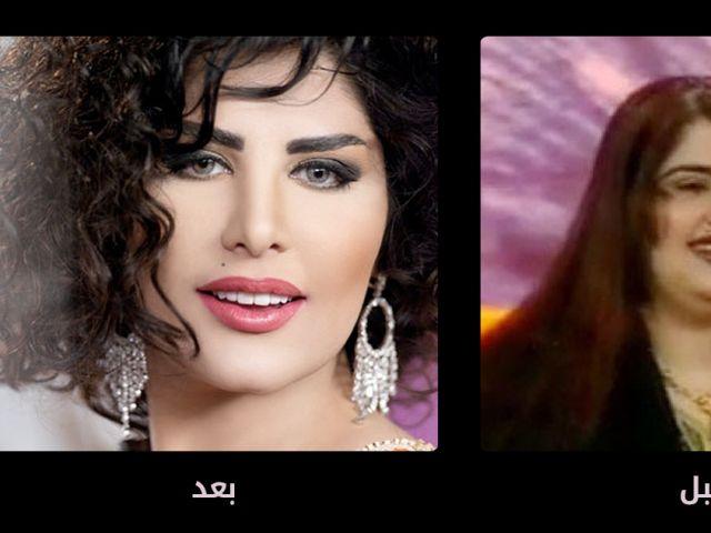 مشاهير عرب قبل وبعد عمليات التجميل 