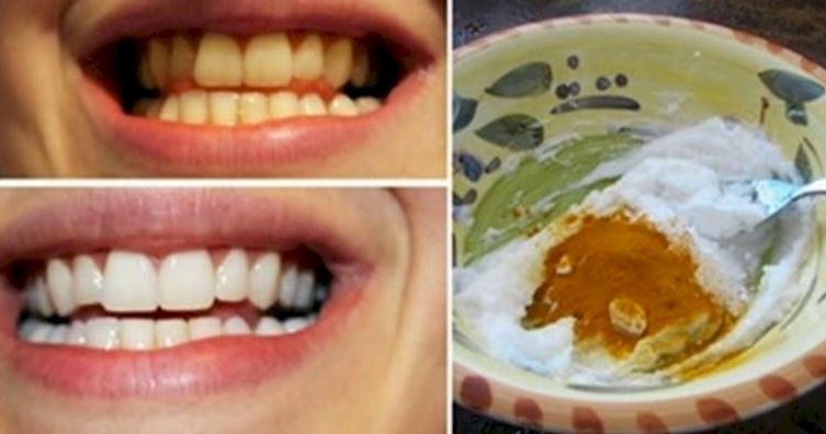 تبيض الاسنان بمكونات منزلية لا تستطيع تصديق النتائج المذهلة