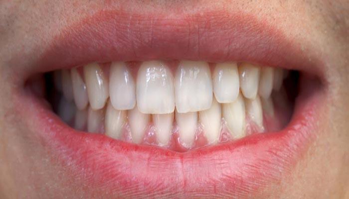 سرطان البنكرياس كيف تزيد مشاكل الأسنان خطر الإصابة بهذا المرض 