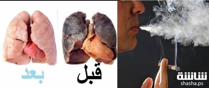 فيديو هل أنت مدخن جرب هذه الوصفة المذهلة لتنظيف الرئة في ثلاثة أيام 