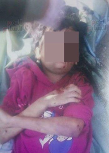 صور مصري قتل ابنته بإطفاء السّجائر في جسدها والسبب عجيب 