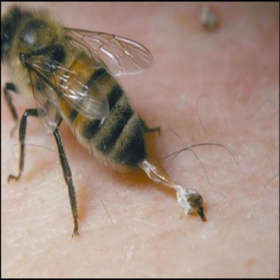 لماذا يموت النحل بعد أن يلسع الإنسان 