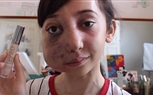 بالفيديو والصور.. فتاة مشوهة الوجه تتحول لنجمة يوتيوب بنصائح المكياج