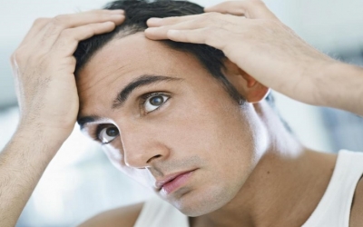 نتف شعيرات الرأس يحفز نمو الشعر لعلاج الصلع