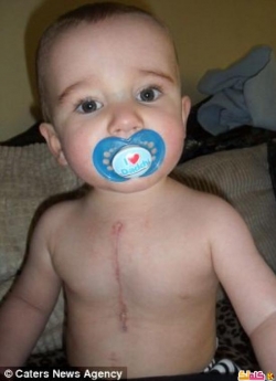 بالصور طفل بستة قلوب منفصلة والأطباء اعتبروه معجزة