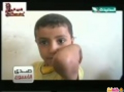 طفل يمني يتبول من انفه