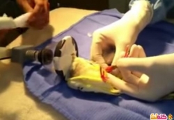 عملية جراحية لعلاج ساق مكسورة لـببغاء الكروان