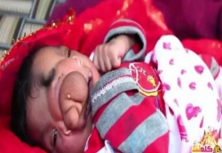 ولادة طفلة بخرطوم فيل فى الهند