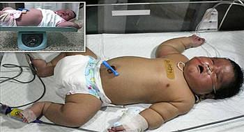 ولادة أكبر طفل في الهند بوزن 7 كيلوغرامات ولادة طبيعية