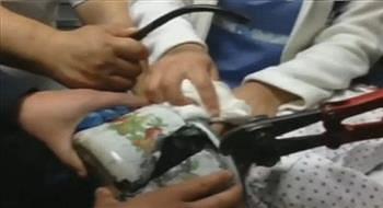 أطباء ورجال إطفاء لإخراج رأس طفلة من إبريق شاي
