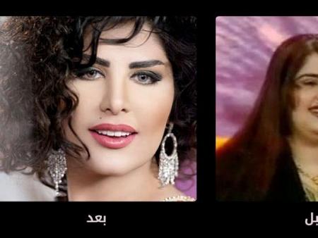 مشاهير عرب قبل وبعد عمليات التجميل!