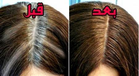 الوصفة السحرية 3 وصفات للتخلص من الشعر الأبيض نهائياً ، وأفضلهم هي الوصفة الثالثة ونتيجتها فعالة 100