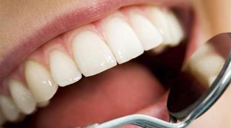 دراسة تربط بين بكتريا في الفم وسرطان البنكرياس