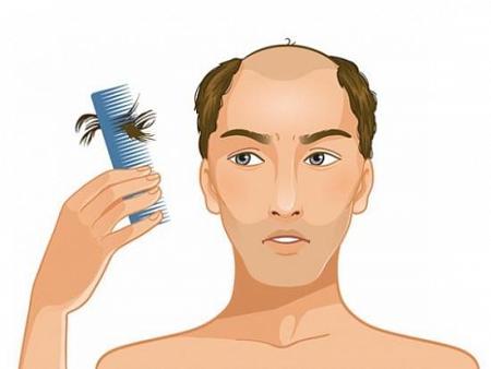 نصائح لعلاج تساقط الشعر في رمضان