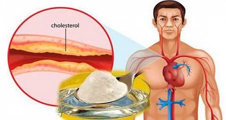 أفضل علاج للكولسترول وارتفاع ضغط الدم