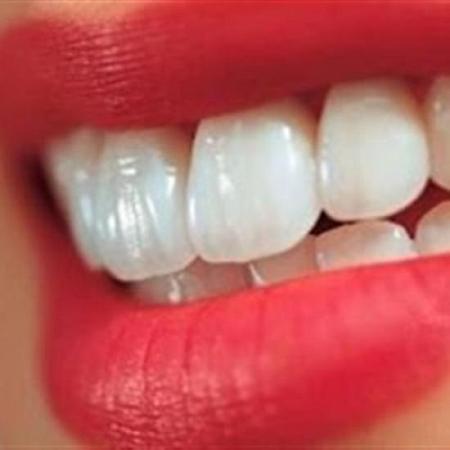 بالفيديو طريقة طبيعية لتبييض الأسنان