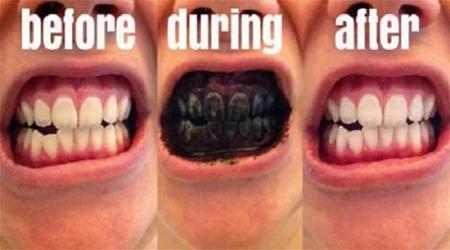 بالفيديو تبييض الأسنان بالفحم صيحة جديدة على الإنترنت