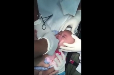 وصل الرضيع إلى المستشفى بدون أي حركة وفوجئ الأطباء عندما شاهدوا ما خرج من فمه
