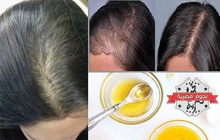 وصفة بسيطة لعلاج الشعر الخفيف وحالات الصلع