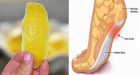 تخلص من آلام المفاصل للأبد باستخدام قشور الليمون