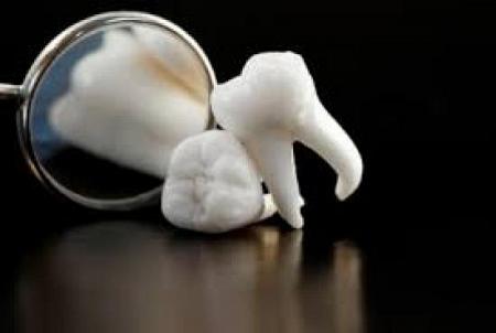 هل يشكل خلع الاسنان خطر على مرضى السكري ؟