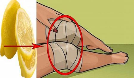 وصفة الليمون للتخلص من آلام الركبتين