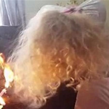بالفيديو والصور لحظة اشتعال النيران بشعر طفلة في عيد ميلادها