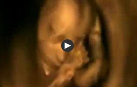 فيديو يحبس الأنفاس هذا ما يفعله الطفل في بطن أمه!