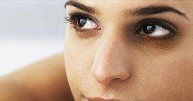 4 عوامل تعرضك للهالات الداكنة تحت العينين أبرزها الحساسية