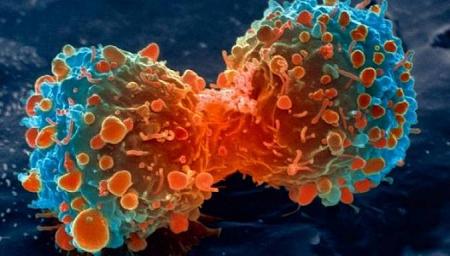 تقنية جديدة تقضي على الخلايا السرطانية في 10 أيام فقط!