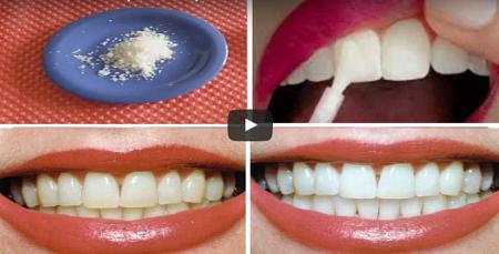 فيديو خلطة برازيلية تبيض الاسنان في 5 دقائق!
