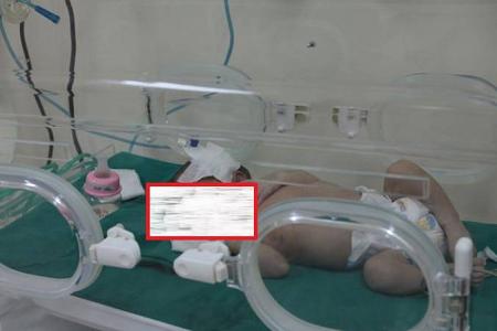 فيديو إحتراق رضيعة في حضّانة مستشفى مصرية وهذا ردّ فعل والدها!!