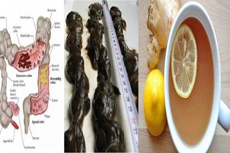خلطة الليمون الحامض والتفاح والزنجبيل تطرد من جسمك عدة كيلوغرامات من السموم أنقذوا صحتكم بها 
