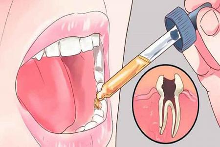 9 وصفات طبيعية لآلام الأسنان لا يريد أطباء الأسنان أن تعرفوها 