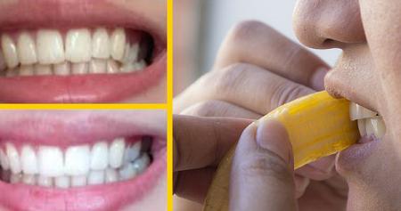 وصفة قشور الموز المذهلة للتخلص من جير الأسنان وستتفاجئ حقاً من بياض أسنانك
